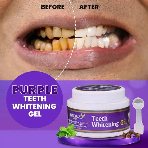 Purple Teeth Whitening Gel: Does It Really Remove Yellow Stains?